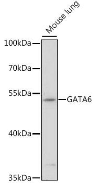 Anti-GATA6 Antibody (CAB16634)