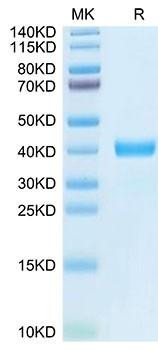 Recombinant Human MFAP4 Protein (RPCB2106)