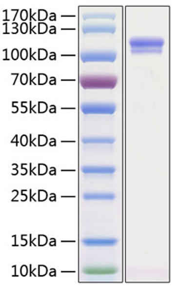 Recombinant Human Autotaxin/E-NPP2 Protein (RPCB2109)