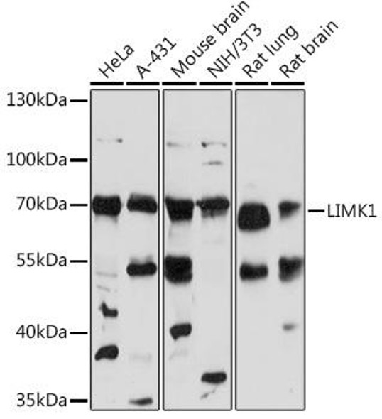 Anti-LIMK1 Antibody (CAB16664)