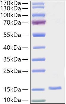Recombinant Human EG-VEGF/PK1 Protein (RPCB2130)