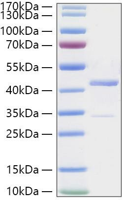 Recombinant Human PCBP1 Protein (RPCB2134)