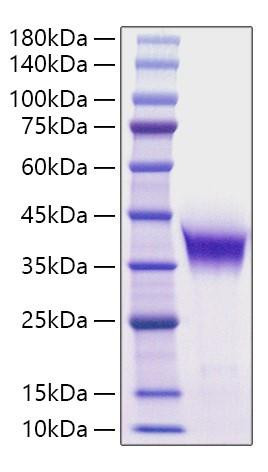 Recombinant Mouse Farnesyl pyrophosphate synthase/FDPS Protein (RPCB2140)