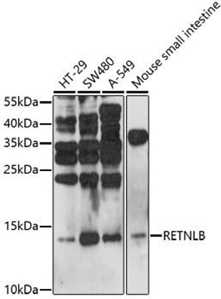 Anti-RETNLB Antibody (CAB17228)