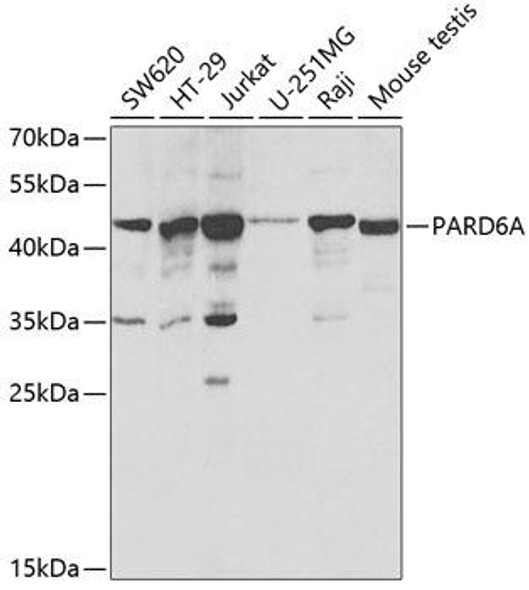 Anti-PARD6A Antibody (CAB3064)