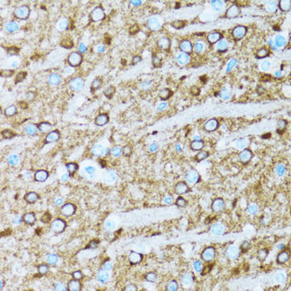 Anti-ENO2 Antibody (CAB3118)