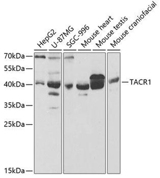 Anti-TACR1 Antibody (CAB5565)