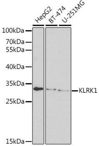Anti-KLRK1 Antibody (CAB6123)