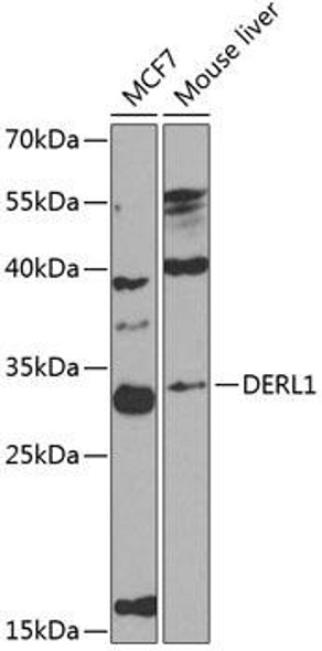 Anti-Derlin-1 Antibody (CAB8508)