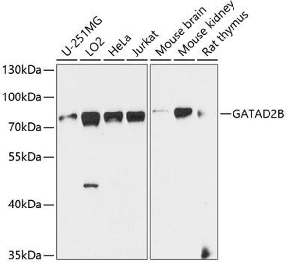 Anti-GATAD2B Antibody (CAB9716)