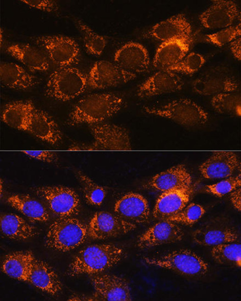 Anti-BCKDHA Antibody (CAB9806)