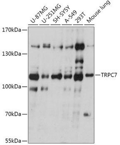 Anti-TRPC7 Antibody (CAB17738)