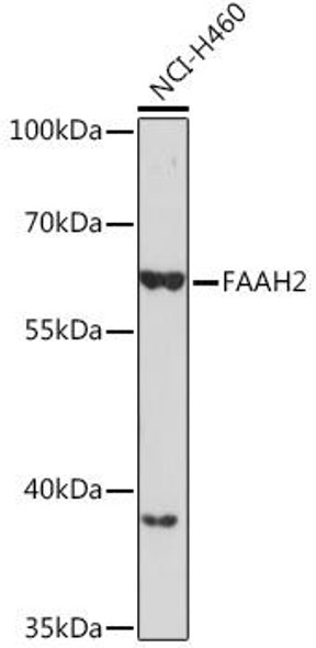Anti-FAAH2 Antibody (CAB18554)