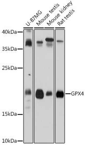 Anti-GPX4 Antibody (CAB1933)