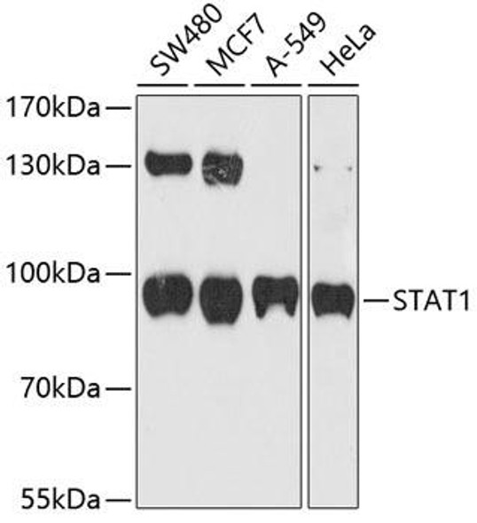 Anti-STAT1 Mouse Monoclonal Antibody (CAB10100)