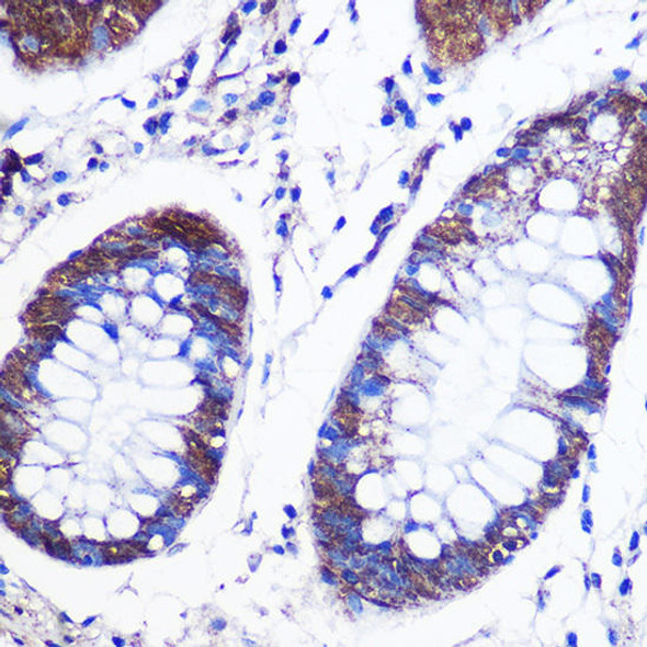 Anti-LSM4 Antibody (CAB13588)