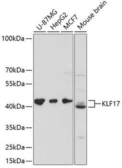 Anti-KLF17 Antibody (CAB13743)