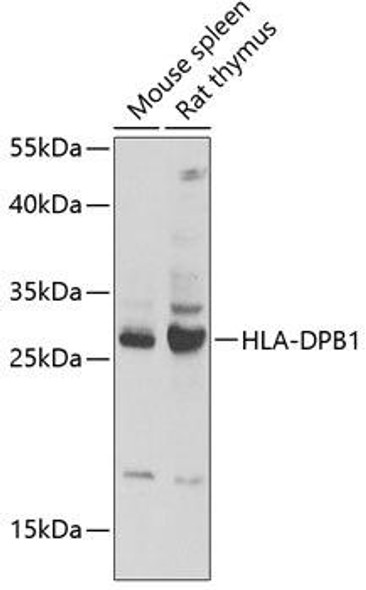 Anti-HLA-DPB1 Antibody (CAB13997)