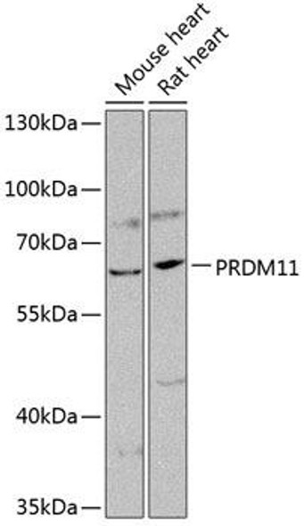 Anti-PRDM11 Antibody (CAB14143)