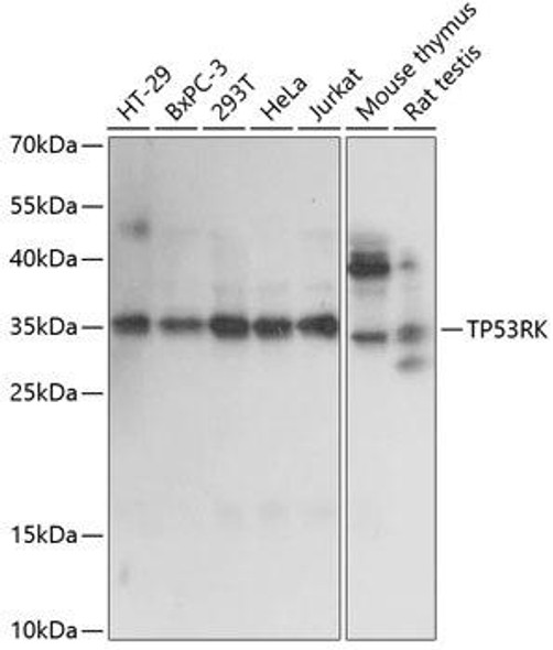 Anti-TP53RK Antibody (CAB14952)