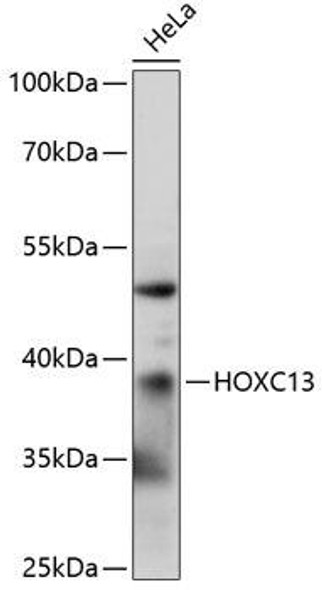 Anti-HOXC13 Antibody (CAB14998)