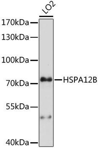 Anti-HSPA12B Antibody (CAB15206)