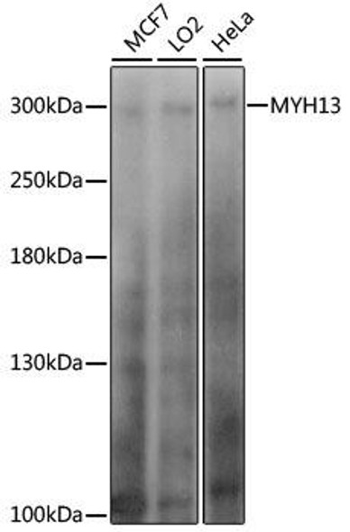 Anti-MYH13 Antibody (CAB15343)
