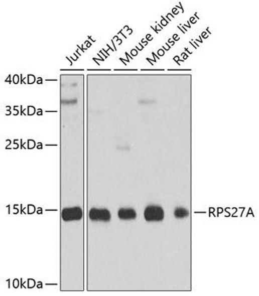 Anti-RPS27A Antibody (CAB2027)
