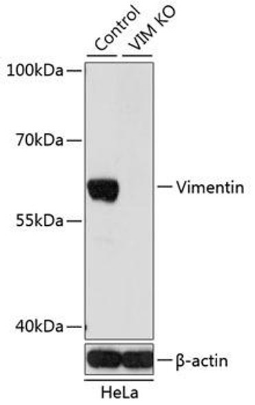 Anti-Vimentin Antibody (CAB2666)[KO Validated]