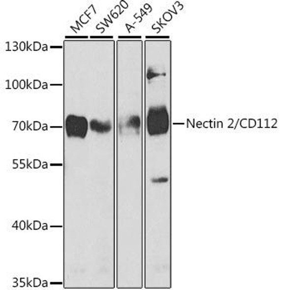 Anti-Nectin 2/CD112 Antibody (CAB5378)