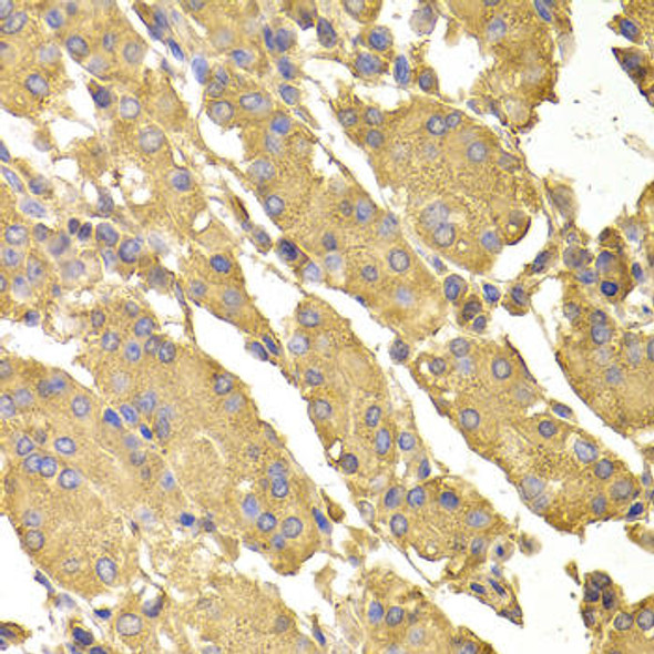 Anti-PPP2CA Antibody (CAB6702)