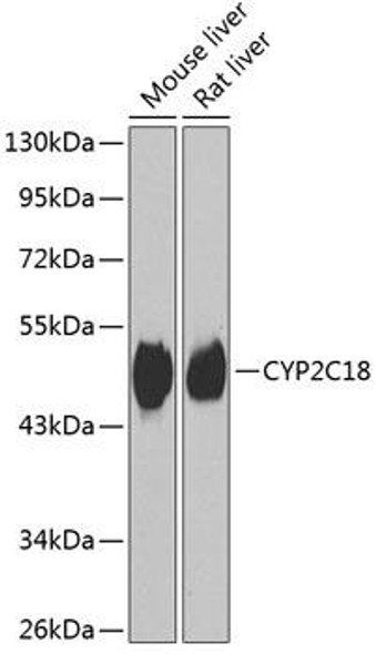 Anti-CYP2C18 Antibody (CAB7431)