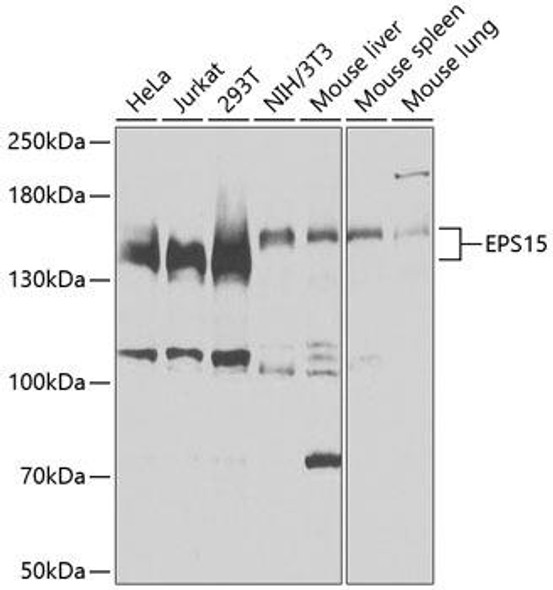 Anti-EPS15 Antibody (CAB9814)