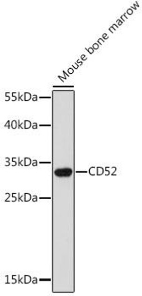Anti-CD52 Antibody (CAB16815)