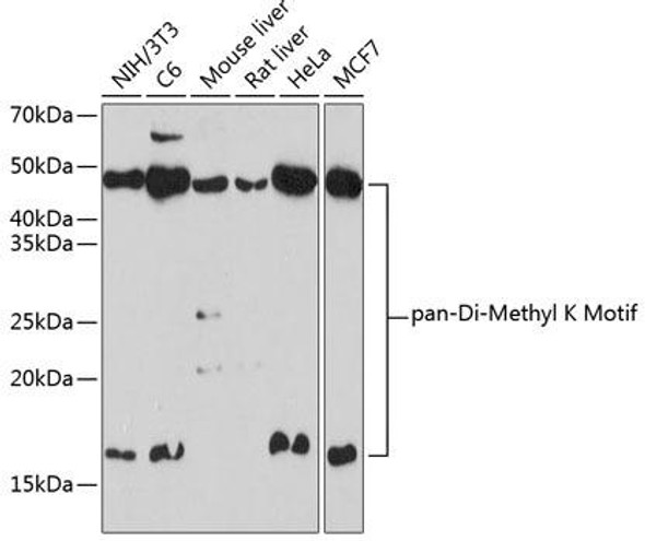 Anti-Pan DiMethyl-lysine Antibody (CAB18296)