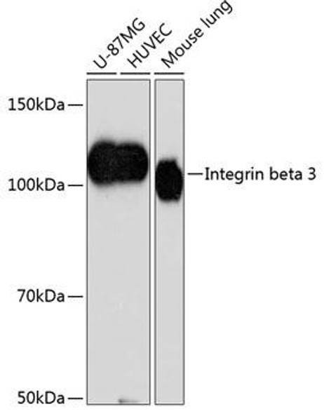 Anti-Integrin beta 3 Antibody (CAB19073)