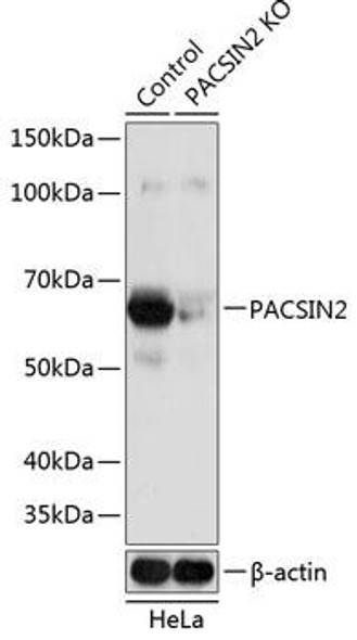 Anti-PACSIN2 Antibody (CAB19941)[KO Validated]