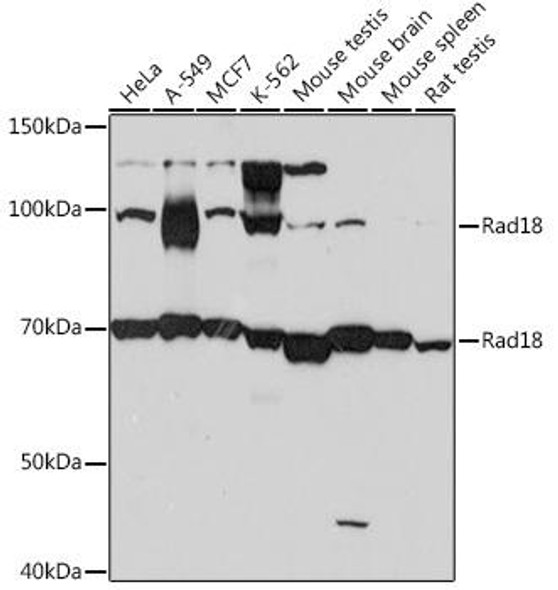 Anti-Rad18 Antibody (CAB4339)
