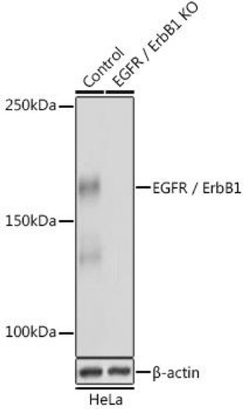 Anti-EGFR / ErbB1 [KO Validated] Antibody (CAB4929)
