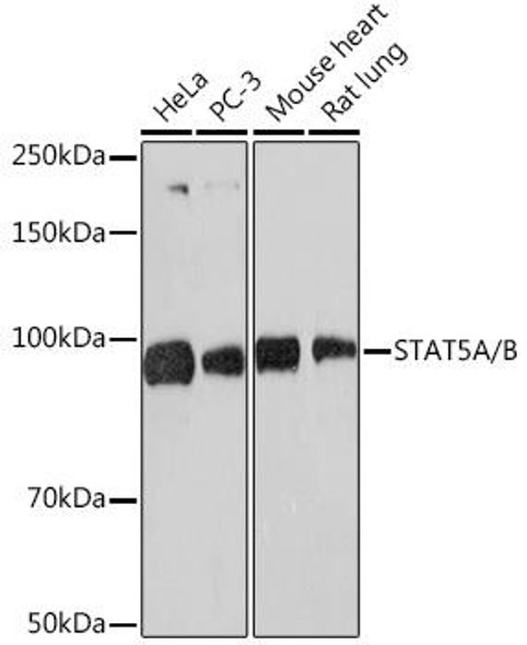 Anti-STAT5A/B Antibody (CAB5029)