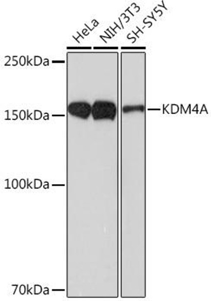 Anti-KDM4A Antibody (CAB9267)