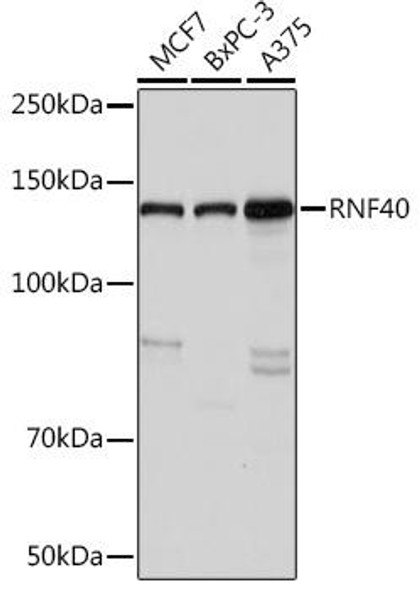 Anti-RNF40 Antibody (CAB9598)