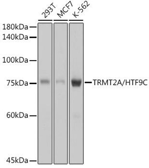 Anti-TRMT2A/HTF9C Antibody (CAB0136)