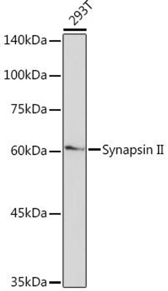 Anti-Synapsin II Antibody (CAB19542)