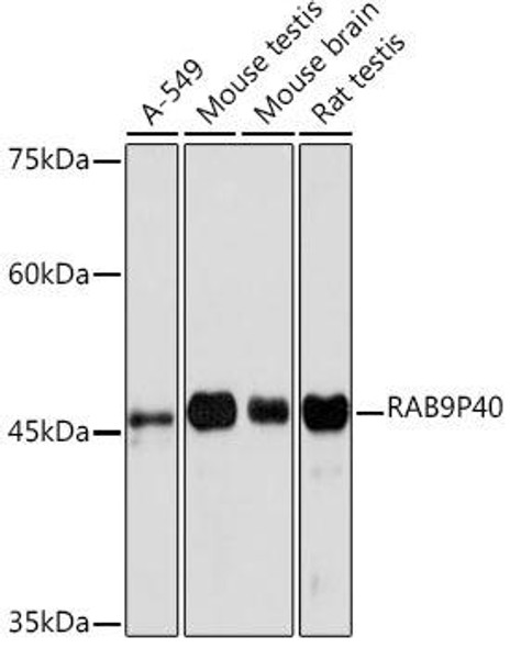 Anti-RAB9P40 Antibody (CAB19616)