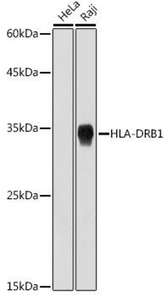 Anti-HLA-DRB1 Antibody (CAB19835)