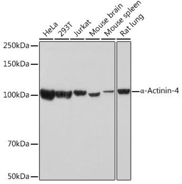Anti-alpha-Actinin-4 Antibody (CAB3379)