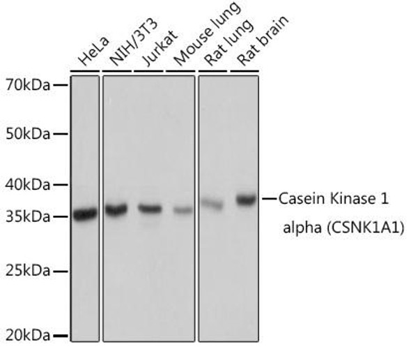Anti-Casein Kinase 1 alpha (CSNK1A1) Antibody (CAB9308)