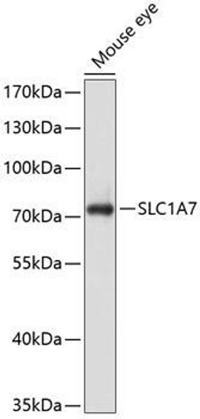 Anti-SLC1A7 Antibody (CAB10244)