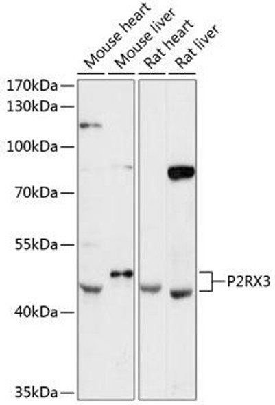 Anti-P2RX3 Antibody (CAB12965)